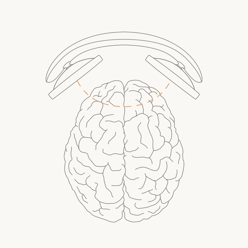 Animation of tDCS stimulating the dorsolateral prefrontal cortex